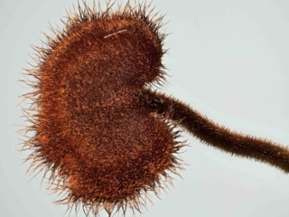 Auriscalpium vulgare – Ohrlöffel-Stacheling, die behaarte Hutoberfläche