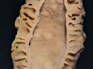 Morchella elata – Spitz-Morchel, Längsschnitt, innen ist die Morchel hohl